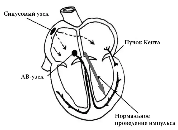 Рис 1 Рис 2 Рис 3 Метод лечения хорошо отработан это радиочастотная - фото 95