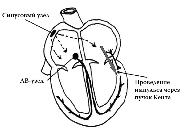 Рис 2 Рис 3 Метод лечения хорошо отработан это радиочастотная абляция - фото 96
