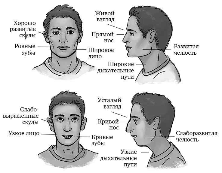 Рисунок 3Основные различия строения лица у людей которые дышат носом сверху - фото 5