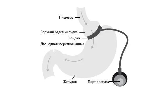 Код диабета Научные данные о том как диабет 2го типа стал самой внезапной болезнью столетия и простая программа восстановления без инъекций и лекарств - изображение 110