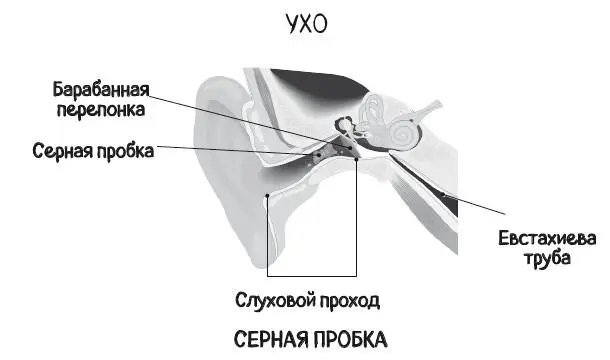 Почему болит ухо Что делать при отитах снижении слуха и звоне в ушах правила доказательной медицины - изображение 28