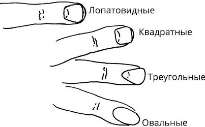 Б Форма ногтей Бороздки на ногтях важное указание на состояние здоровья Они - фото 8