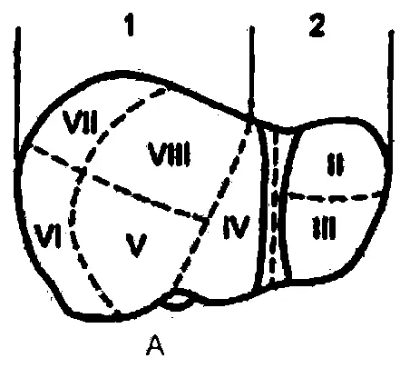 Рис 2 Сегментарное деление печени А диафрагмальная поверхность Б - фото 2