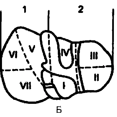 Рис 2 Сегментарное деление печени А диафрагмальная поверхность Б - фото 3