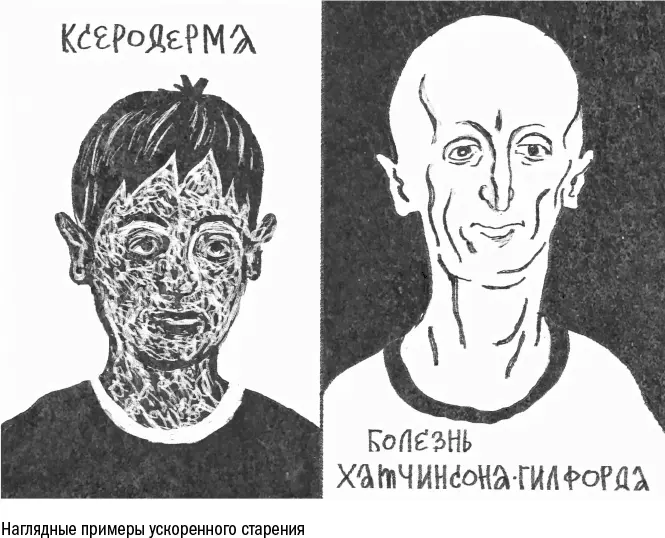 Лечить прогерию мы пока не умеем можем разве что компенсировать эффект от - фото 21