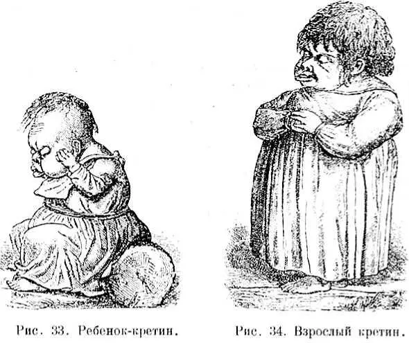Все это говорит за то что тироксин необходим для правильной работы мозга Для - фото 51