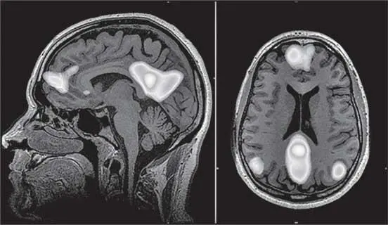 Рис 40 Структуры дефолтсистемы мозга выделены светлым Вероятно эта - фото 40