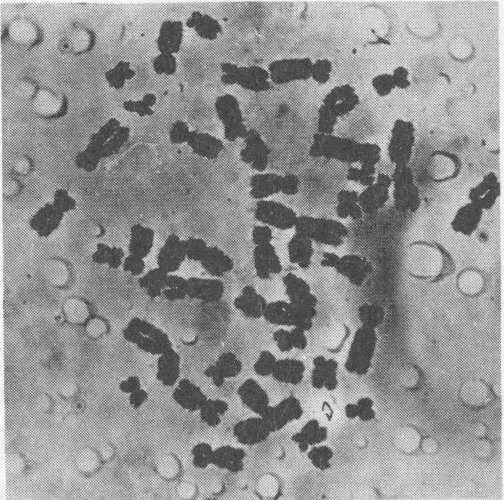 Cell after treatment with salt solution The separate chromosomes in a - фото 6