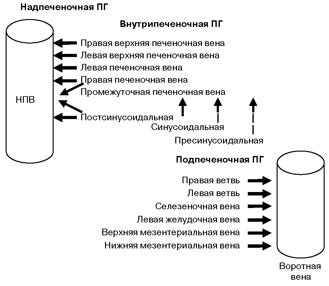 Рис 8 Анатомическая систематизация портальной гипертензии НПВ нижняя полая - фото 8