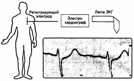 Рис 19 Регистрирующий электрод электрокардиограф лента ЭКГ 5 Графическое - фото 19