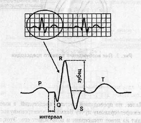 Рис 2 Лента ЭКГ зубцы и интервалы I2 Зубец Р Электрический потенциал - фото 2