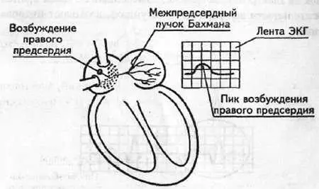 Рис 3 Пик возбуждения правого предсердия Далее по проводящей системе - фото 3