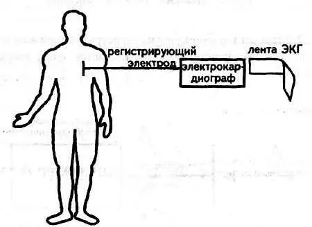 Рис 17 Регистрирующий электрод электрокардиограф лента ЭКГ 5 Графическое - фото 15