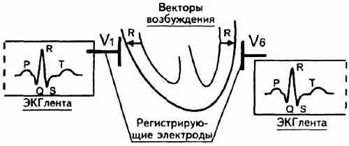 Рис 89 Возбуждение нормального миокарда При возникновении инфаркта миокарда - фото 83