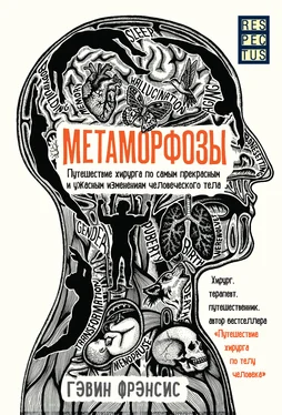 Гэвин Фрэнсис Метаморфозы. Путешествие хирурга по самым прекрасным и ужасным изменениям человеческого тела обложка книги