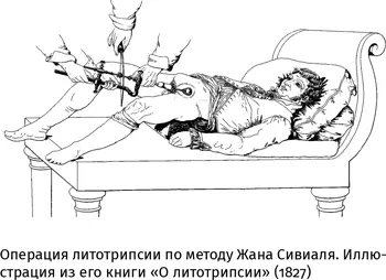 Идея была в том чтобы провести в эту трубочку зажим которым захватывается - фото 31