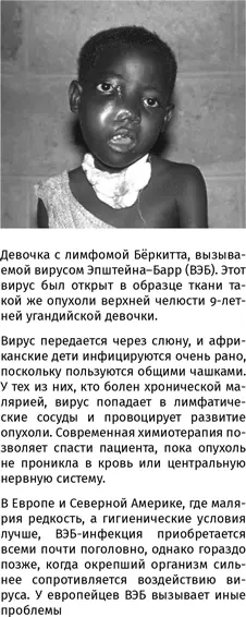 Как только не пишут его название вирус ЭпштейнБарра вирус ЭпштейнБарр - фото 145