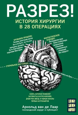 Арнольд Ван Де Лаар Разрез! История хирургии в 28 операциях обложка книги