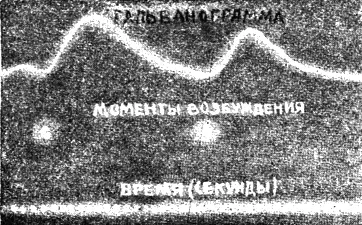 Рис 4 Др Хоуз работающий в Техасе предложил еще более любопытный способ для - фото 63