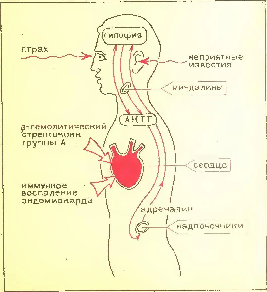 ревмокардит артрит воспаление легких почек и других органов Расстройства - фото 3