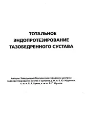 В Мурылев - Тотальное эндопротезирование тазобедренного сустава