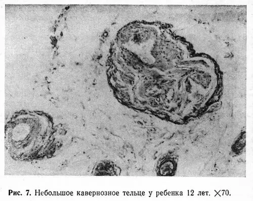 Размеры многокамерных кавернозных вен прямой кишки колеблются в широких - фото 11