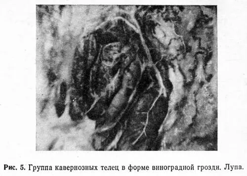 Группы венозных клубочков часто имели форму конуса обращенного основанием к - фото 9