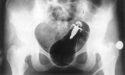 It didnt break Xray of the 95 watt GE Miser lightbulb Bill placed in the - фото 70