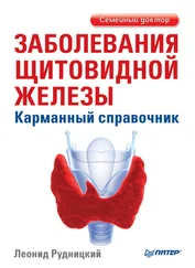 Леонид Рудницкий - Заболевания щитовидной железы. Карманный справочник