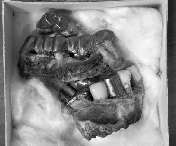 Photo 5 Pieces of Hitlers jaw stored at the archives of the Russian secrets - фото 37