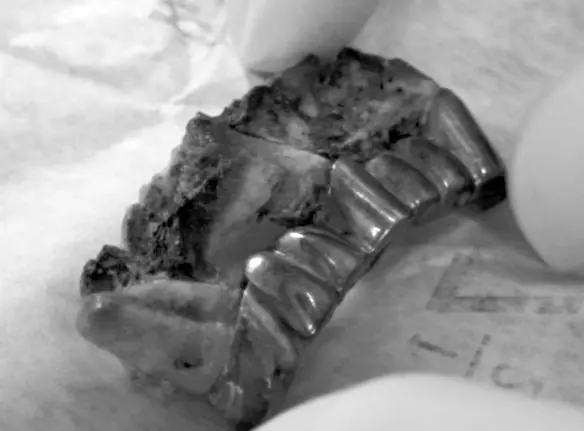 Photo 6 Detail of part of Hitlers teeth The traces of carbonisation on the - фото 38