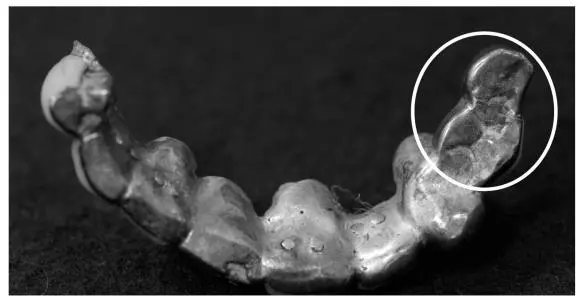 Photo 7 Blue stains that appear on one side of the jaw in white circle are a - фото 39