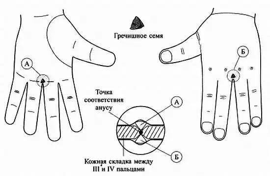 Рис 127 Семянотерапия при геморрое Простым и удобным способом лечения - фото 120