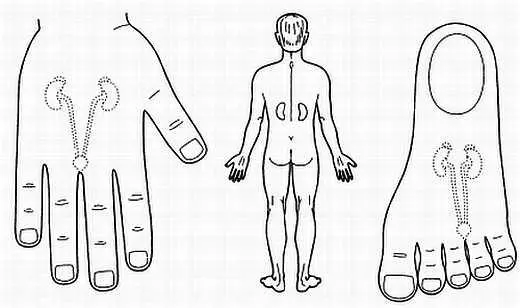 Рис 129 Соответствие почкам и мочеточникам на кисти и стопе Какпомочь при - фото 122