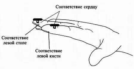 Рис 99 Стимуляция Тобразными пуговицами зон соответствия сердцу в - фото 93