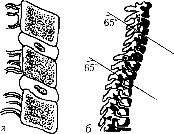 Рис 8 Форма и расположение позвонков в шейном и верхнегрудном отделах - фото 9