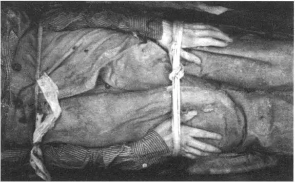 ABOVE BOTTOM John Torrington The body was bound with strips of cotton to - фото 21