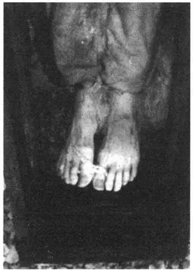 ABOVE BOTTOM John Torrington The body was bound with strips of cotton to - фото 22