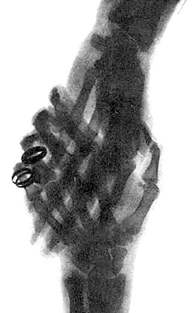 Рукопожатие рентгеновский снимок После этого Рентген проделал еще один опыт - фото 36