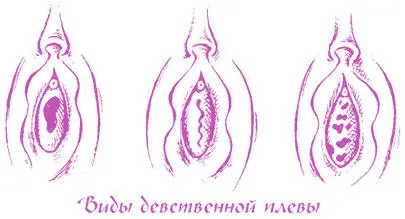 Стенки влагалища вырабатывают специальный секрет который помогает влагалищу - фото 30