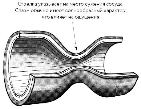 Не надо драматизировать инфаркт миокарда Ситске медицинская сестра перенесла - фото 13
