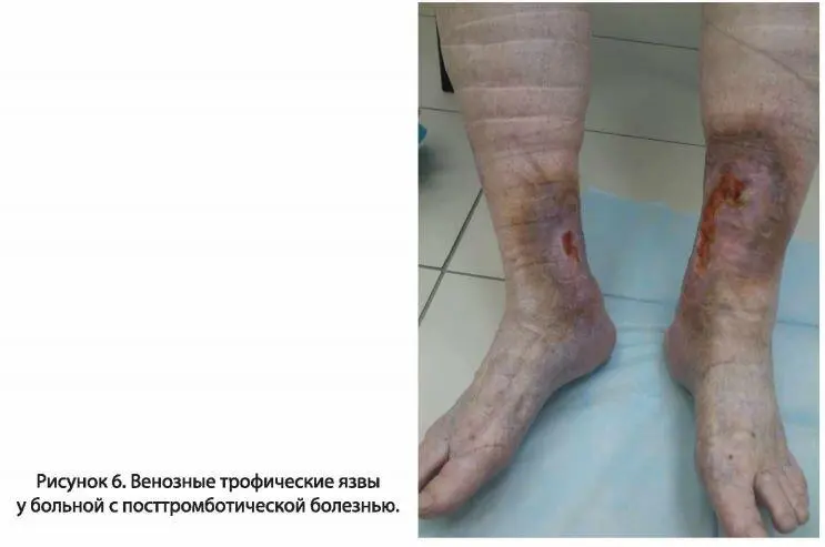 Заболевания угрожающие жизни и здоровью пациента непосредственно - фото 7
