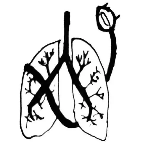 Что же для человека свобода Право жить иметь уважение и своё место в жизни - фото 78