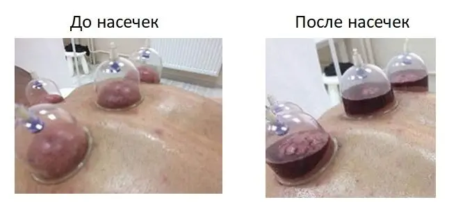 На фото выше кожа натянута ниже половины от высоты самой банки В данном - фото 14