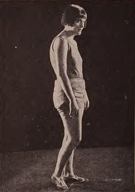 Обычная сутулая поза неправильно тренированного тело Впалая грудь и выпяченный - фото 5