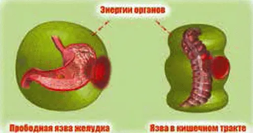 Рис 251 Диагностика полых органов Для проведения например диагностики - фото 66