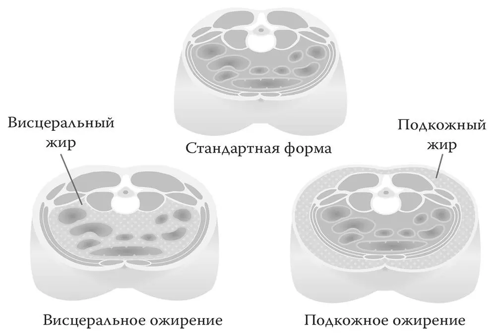 Рис 4 Чем висцеральный жир отличается от подкожного У кого нет умных - фото 56
