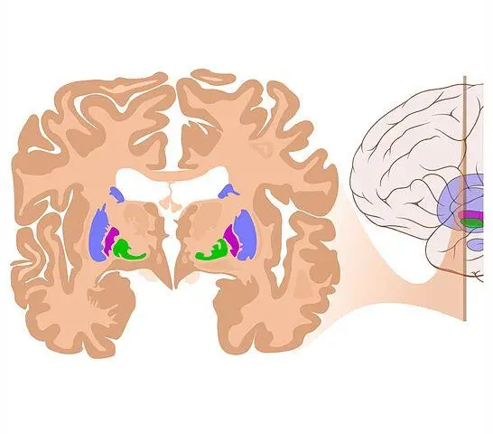 Fig 5 Coronal cut of anterior section of the Brain showing basal ganglia - фото 5
