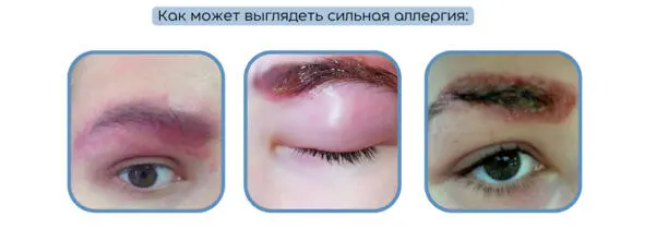 Что делать В срочном порядке отправить клиента к врачу Это первое и - фото 15