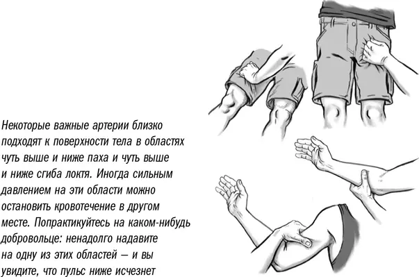 Если вы считаете что жгут необходим действуйте следующим образом 1 Если у - фото 8